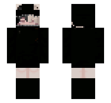 skin