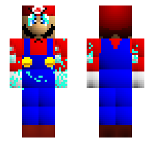 skin