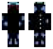 skin