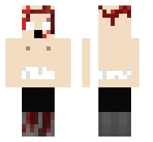 Bobby Mermi vurulmuş hali