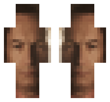 skin