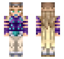 skin
