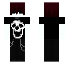 skin