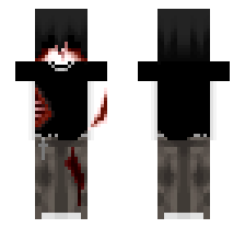 skin