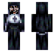 skin