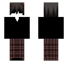 skin