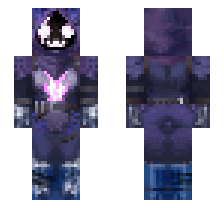 skin