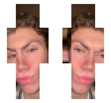 skin