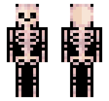 skin