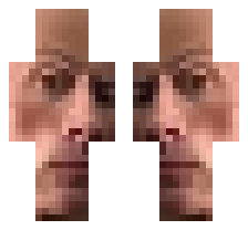 skin