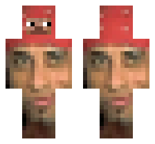 skin