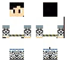 skin