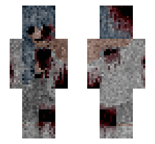 skin